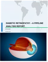 Diabetic Retinopathy - A Pipeline Analysis Report